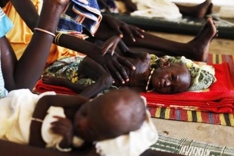 Malnourished children lay next to their mothers at the Medecins Sans Frontieres (MSF) hospital in Leer