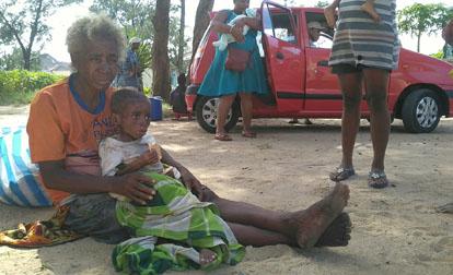 Nome holds 6-year-old Dauphin who suffers from stunting and measles near a health clinic in Fort Dauphin, Madagascar, February 28, 2019. PHOTO BY REUTERS/Rasoanaivo Clarel Faniry