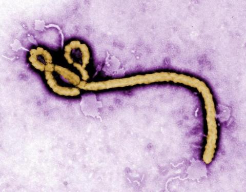 Some of the ultrastructural morphology displayed by an Ebola virus virion is revealed in this undated handout colorized transmission electron micrograph (TEM), August 1, 2014. PHOTO BY REUTERS/Frederick Murphy