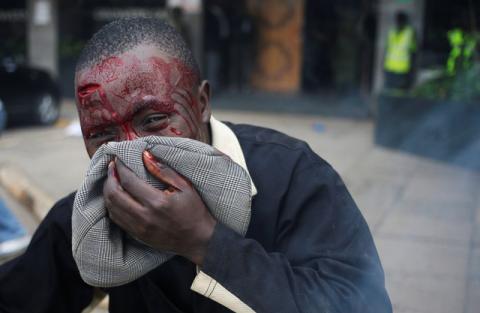 Protester beaten by Kenya policemen bleeds during clashes in Nairobi, Kenya, May 16, 2016. PHOTO BY REUTERS/Goran Tomasevic