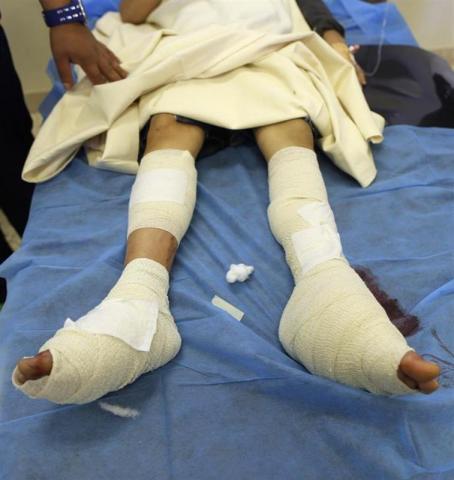 A student, a victim of an attack on a school, lies down on a bed during medical treatment at a hospital in the eastern Libyan city of Benghazi