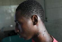 Alassane Diallo, 17, a supporter of presidential candidate Cellou Dalein Diallo, sits on a bed at a clinic after being wounded on his neck by a bullet during clashes between security forces and opposition supporters, in Conakry, October 14, 2015. PHOTO BY REUTERS/Luc Gnago