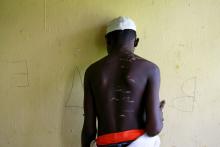 A 15 year-old-boy, one of hundreds of men and boys rescued by police from an institution purporting to be an Islamic school, reveals scars on his back at a transit camp set up to take care of the released captives in Kaduna, Nigeria, September 28, 2019. PHOTO BY REUTERS/Afolabi Sotunde