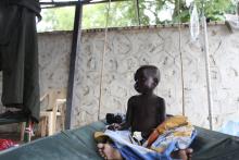 A South Sudanese child suffering from cholera sits on a bed in Juba Teaching Hospital in Juba