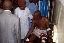 Senator Shehu Sani, speaks with an injured victim of the Sabon-Gari Local Government Secretariat bomb blast, on the outskirts of the city of Zaria, in Kaduna, Nigeria, July 8, 2015. PHOTO BY REUTERS/Stringer