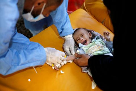 A baby boy cries while being treated at a cholera treatment centre at al-Sabeen hospital in Sanaa, Yemen, October 3, 2018. PHOTO BY REUTERS/Khaled Abdullah