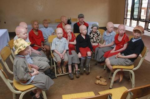 Children with albinism sit at the Golden Valley English Medium School, a school sponsored by Under the Same Sun (UTSS), in Geita, November 24, 2011. PHOTO BY REUTERS/Emmanuel Kwitema