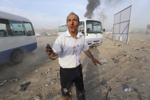 A man wounded after a car bomb attack during a Shi'ite political organisation's rally reacts at the site in Baghdad