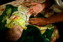 A nurse touches the hand of patient Iraqi girl Nawras Raed, six month, at a hospital run by Medecins Sans Frontieres in Qayyara, Iraq, April 6, 2017. PHOTO BY REUTERS/Suhaib Salem
