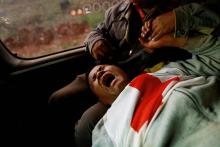 Moe Kyaw Than, 45, a volunteer with the Myanmar Red Cross Society reacts after he was wounded when the convoy he was in, was fired upon by the Myanmar National Democratic Alliance Army (MNDAA), according to the Myanmar army, between the capital of Kokang, Laukkai, and Chinshwehaw, February 17, 2015. REUTERS/Soe Zeya Tun